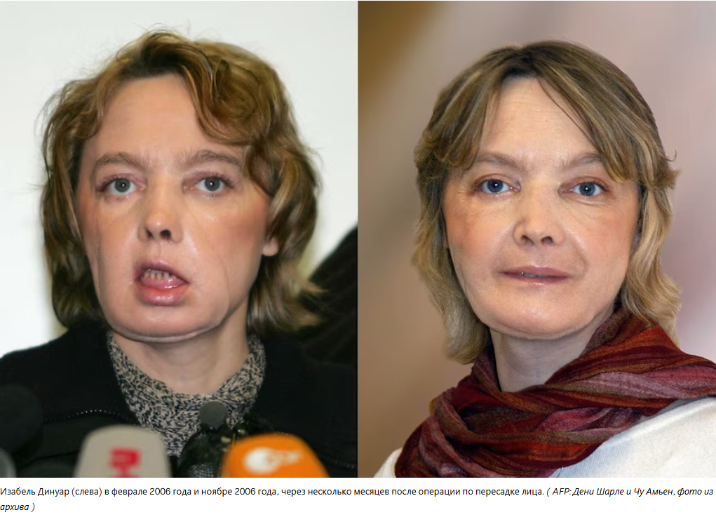 Изабель Динуар