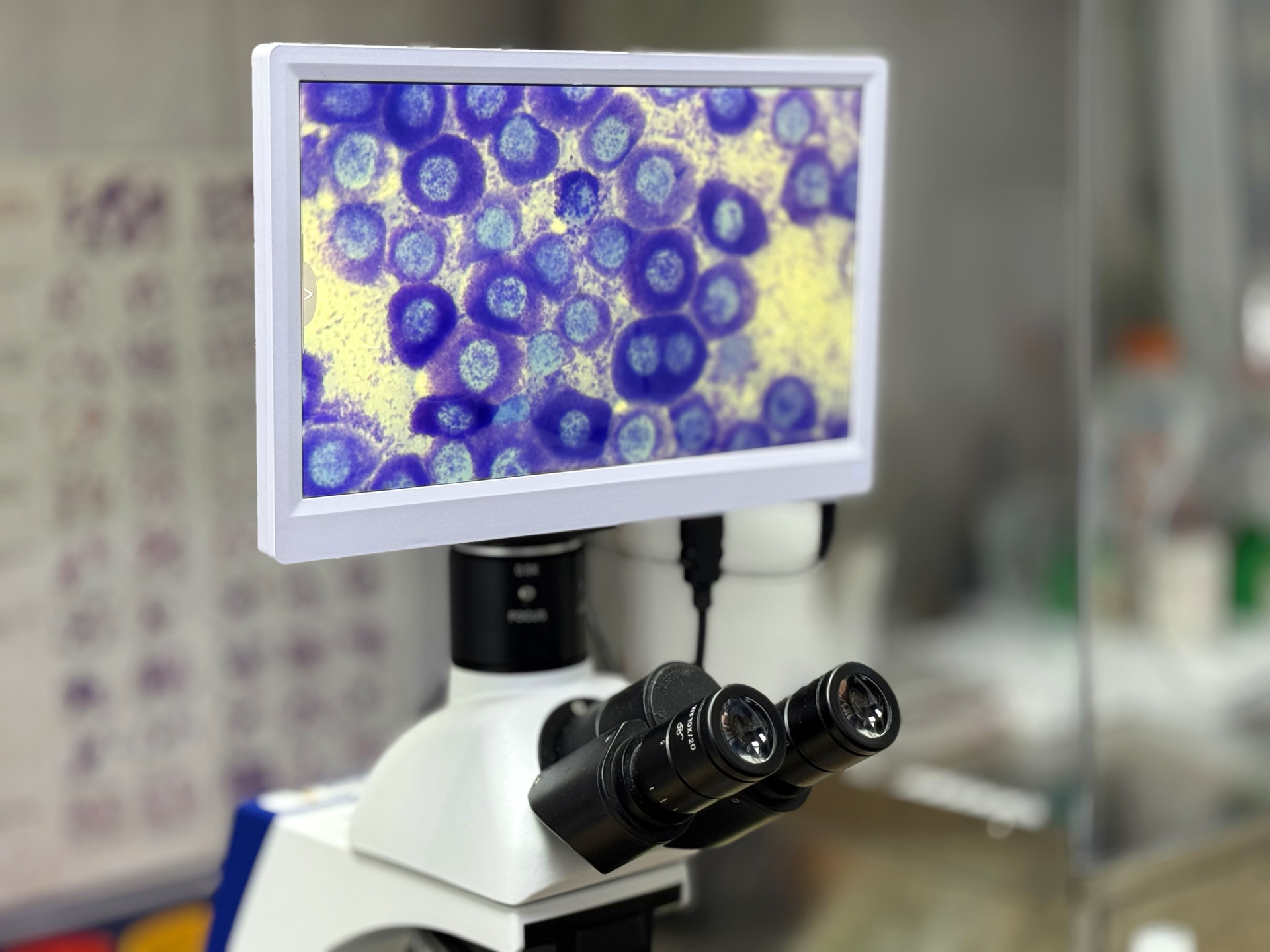 Мастоцитома под микроскопом