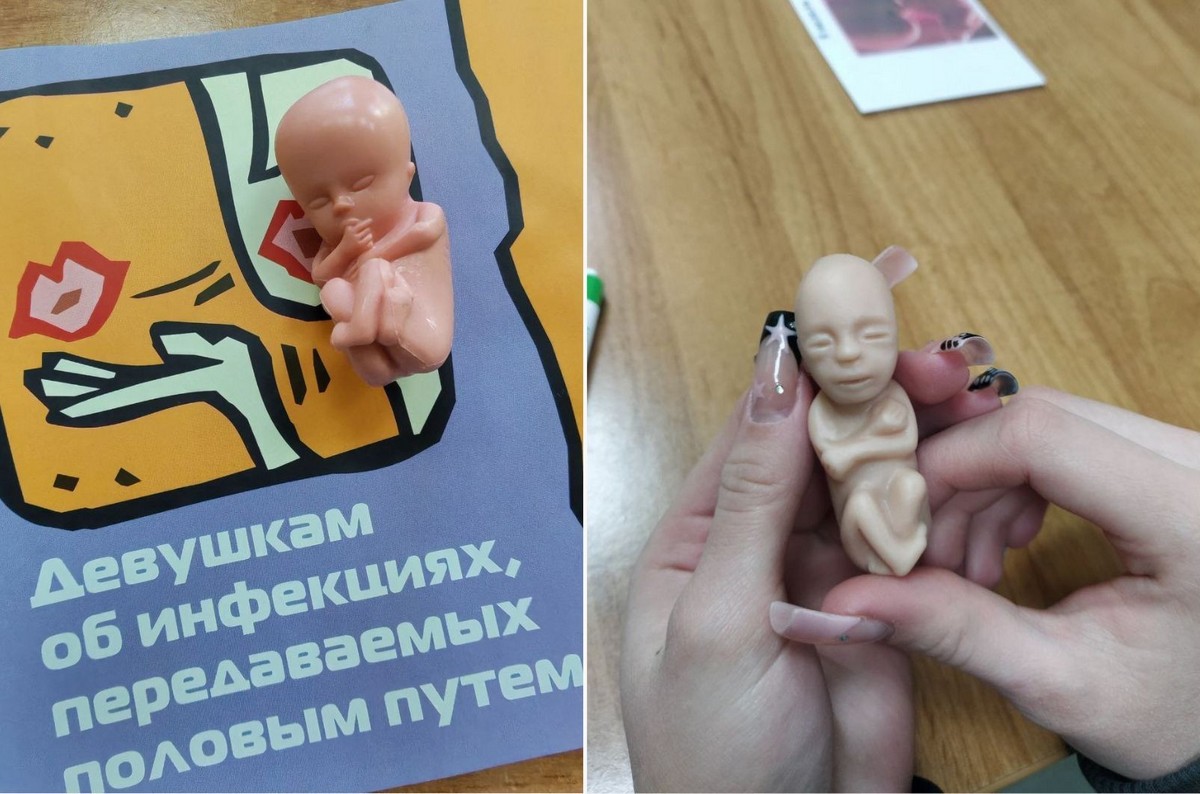 7-Так выглядят модели эмбрионов 10-11 недель беременности которые доктор берет с собой на лекции.jpg