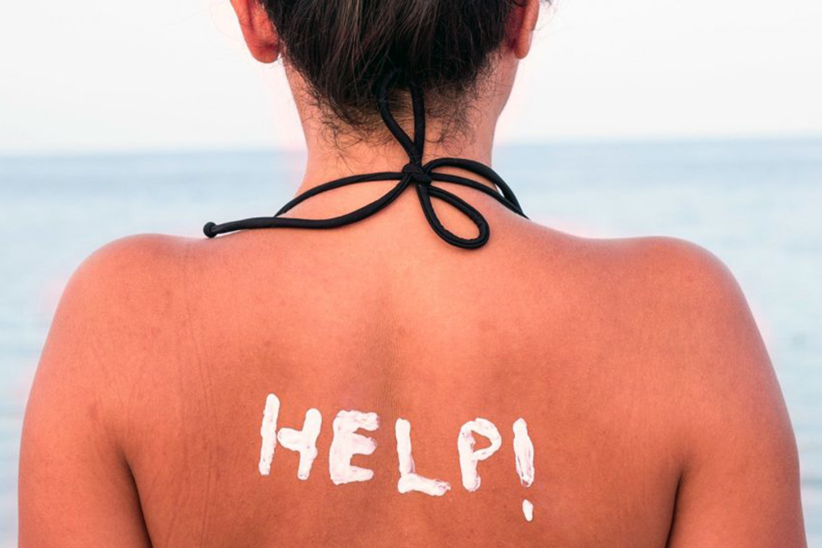 Солнечный ожог фото 24health.by