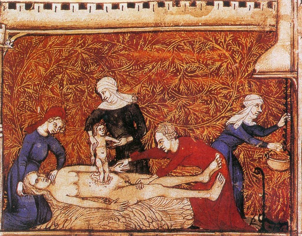 В XVI веке французский врач Амбруаз Паре уже делал кесарево сечение.jpg