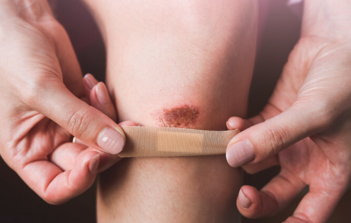 раны лучше не игнорировать.png