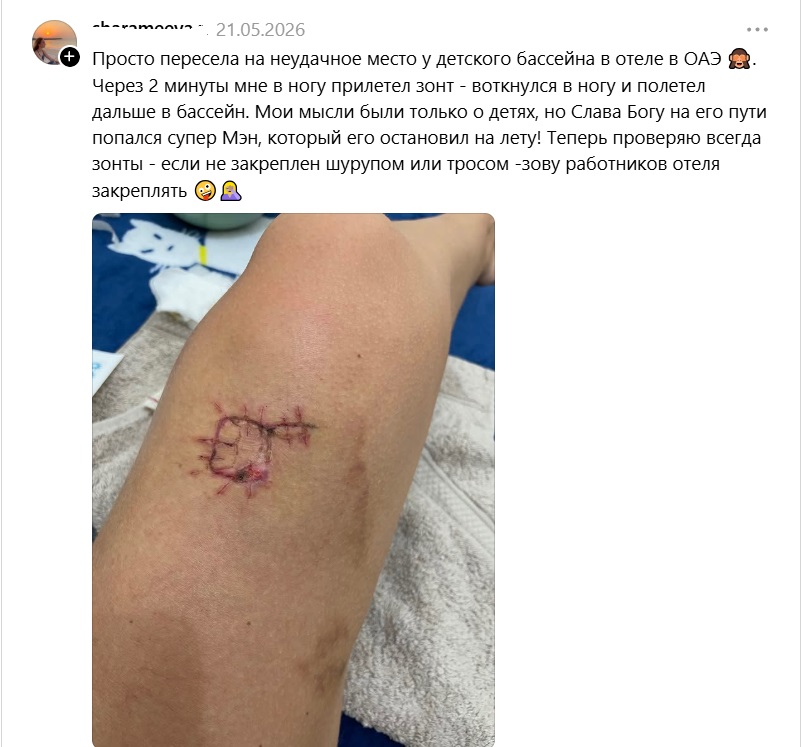 в ногу воткнулся зонт
