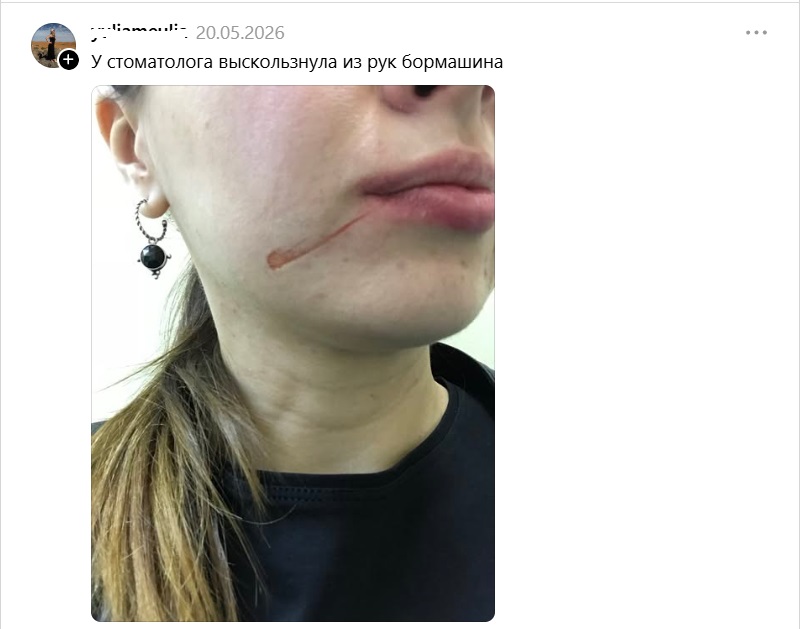 у стоматолога