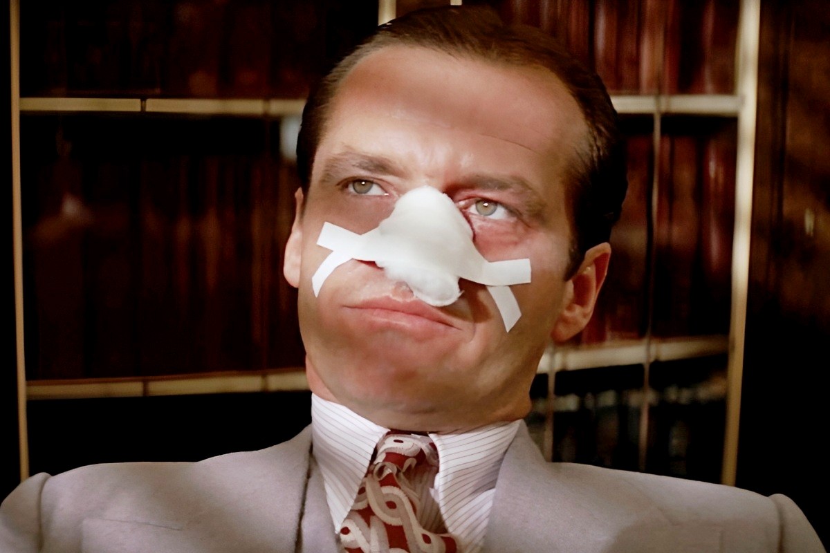 3-Самая популярная операция у белорусских мужчин - ринопластика кадр из фильма Китайский квартал.jpg