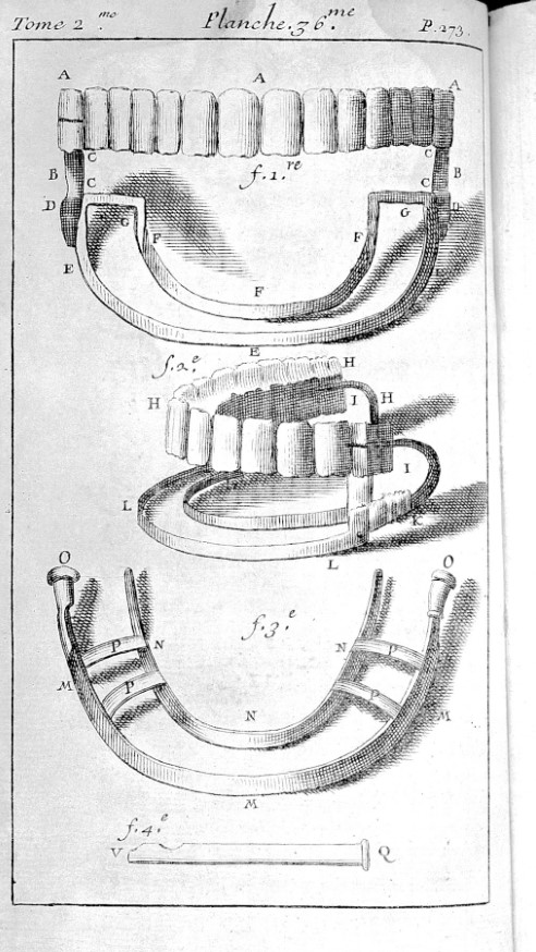 Зубы брекеты 
