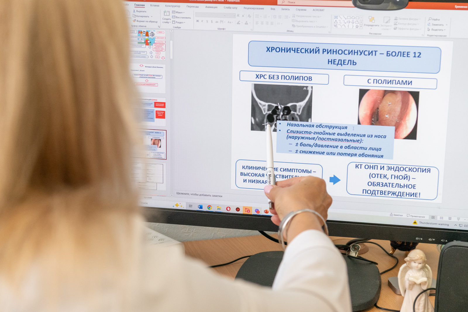 Хронический риносинусит