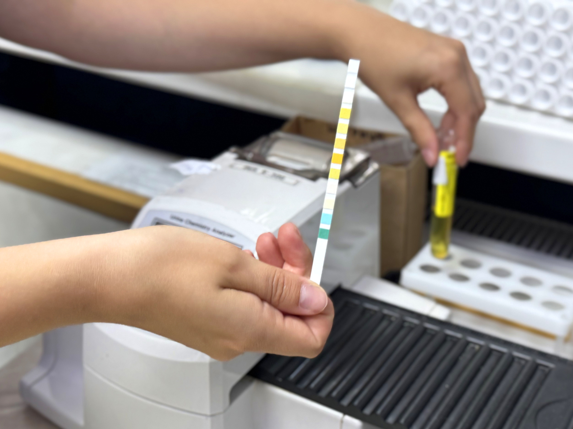 Анализ мочи