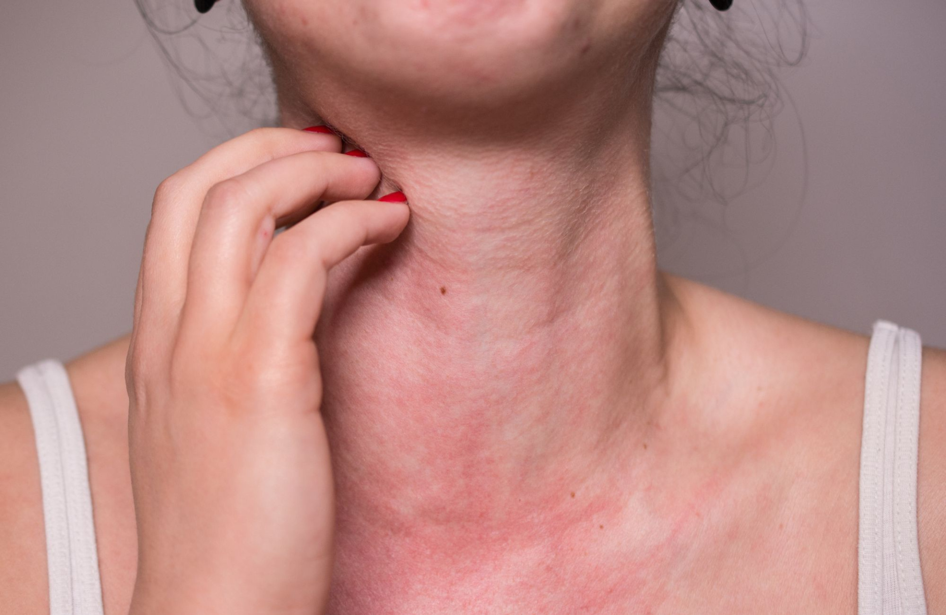 Перекрестная аллергия 3.jpg