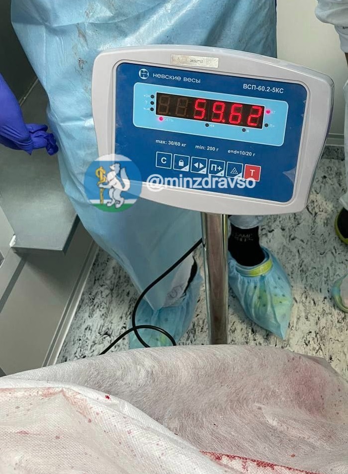 опухоль на весах