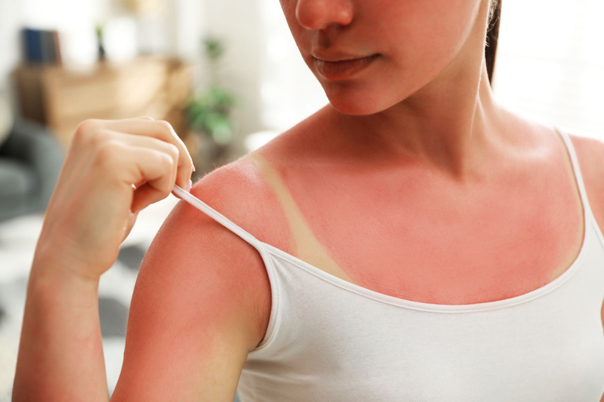 Ожог фото rigla.ru