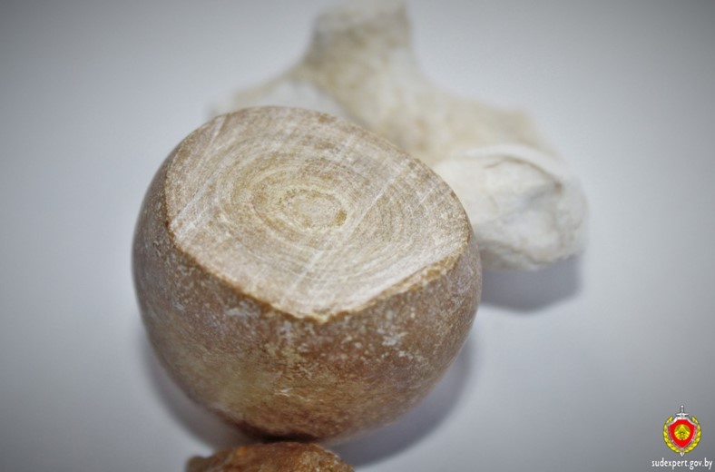 почечный камень почечный камень