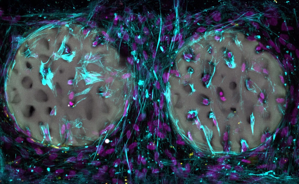 Клетки, формирующие костную ткань (фиолетовые), уже колонизировали костную структуру на основе гидрогеля и вырабатывают коллаген (светло-голубые)