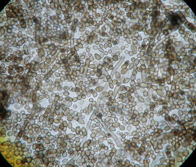 Гриб под микроскопом