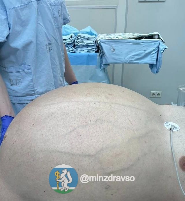 до операции