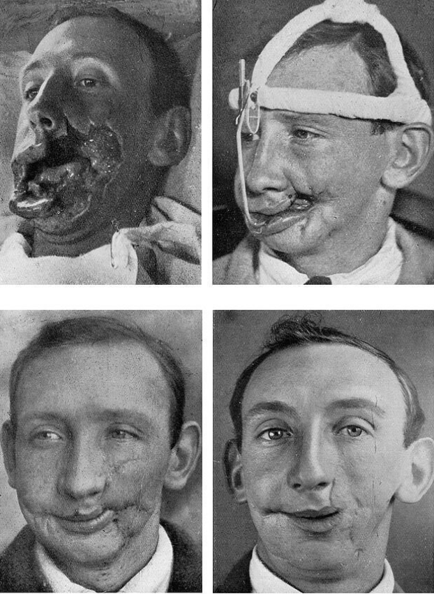 работа команды Гарольда Гиллиса