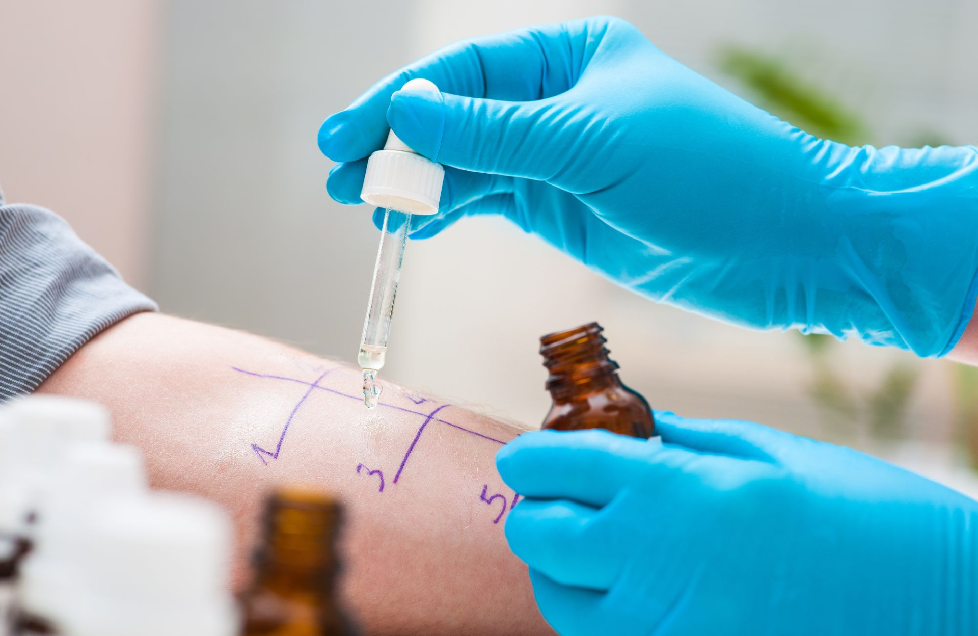 Скарификационные тесты