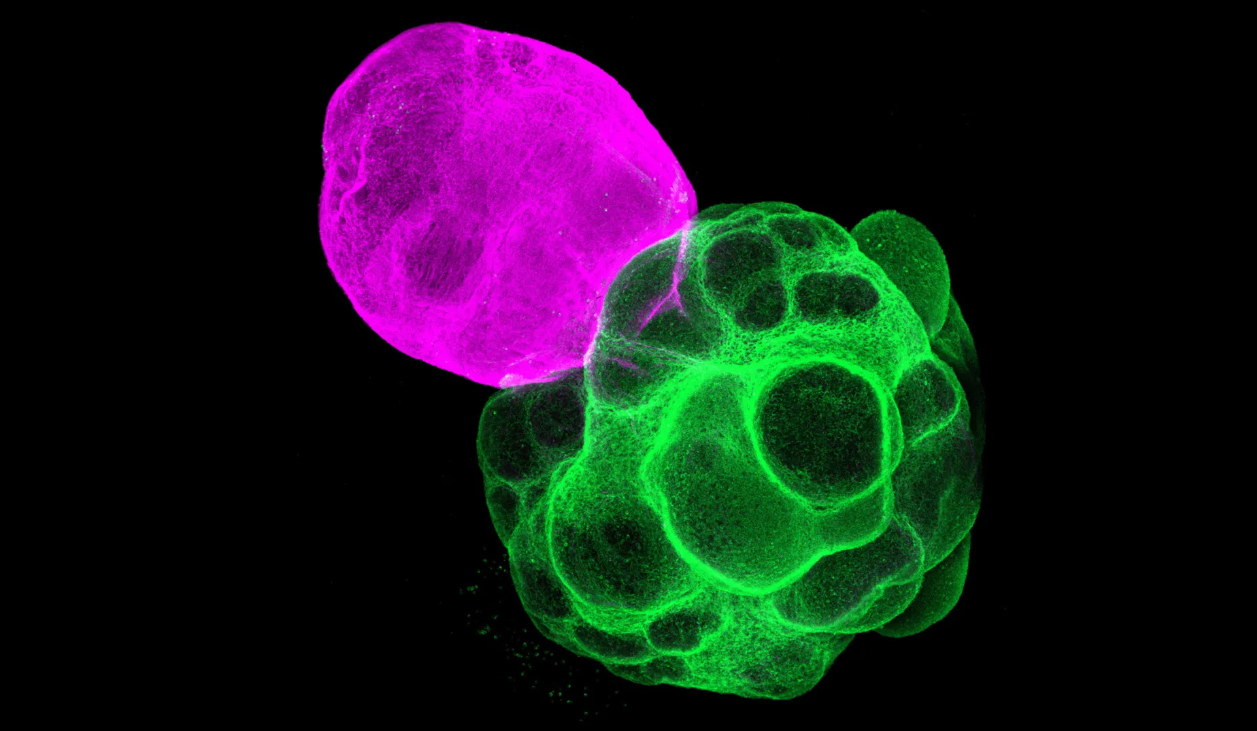 Аксоны в таламусе (розовые) тянулись к коре головного мозга, а аксоны в коре (зеленые) — к таламусу через 14 дней после слияния. Фото Фумитака Осакада
