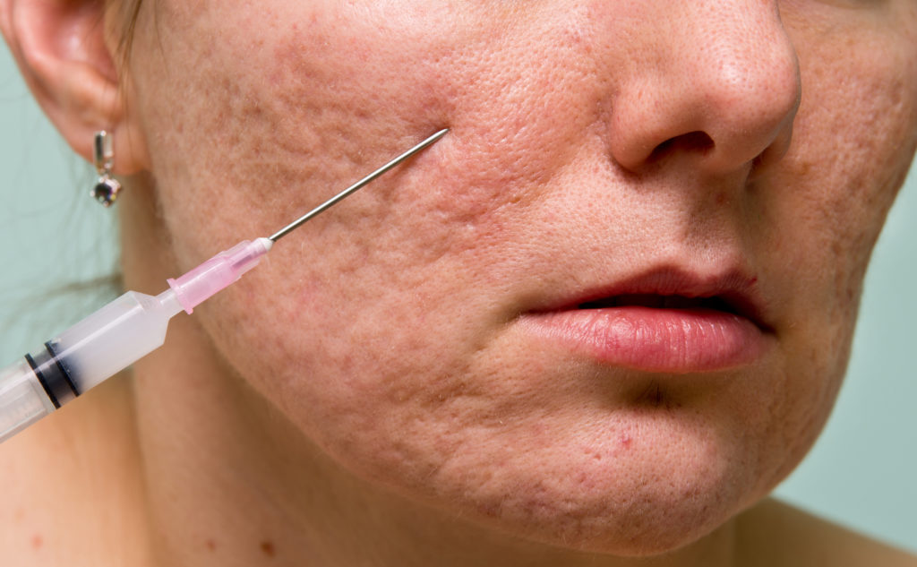 Шрамы и рубцы1.jpg