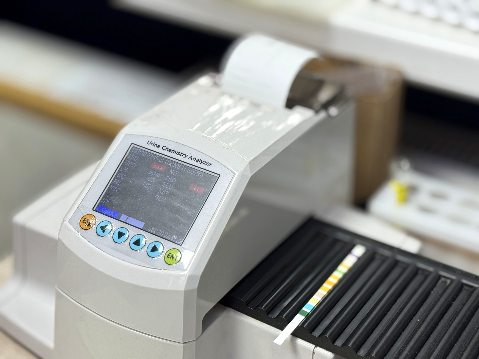 Анализатор мочи