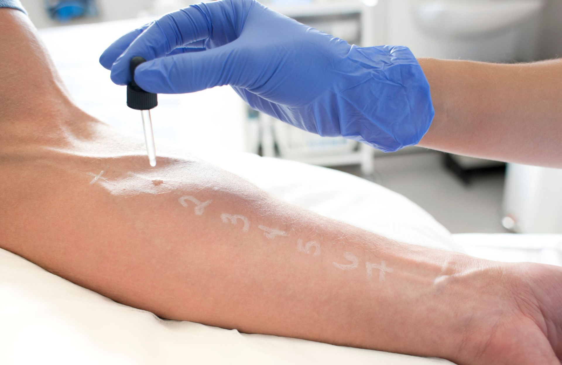 Перекрестная аллергия 6.jpg