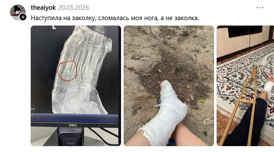 наступила на заколку
