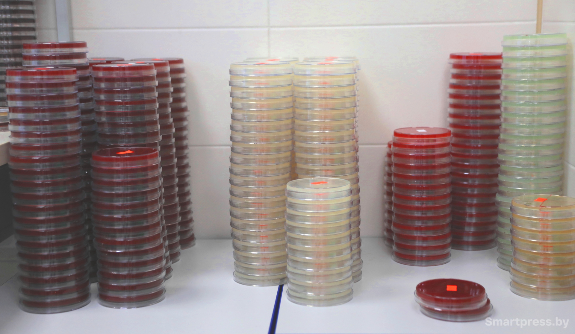 Разные виды питательных сред на столе лаборанта