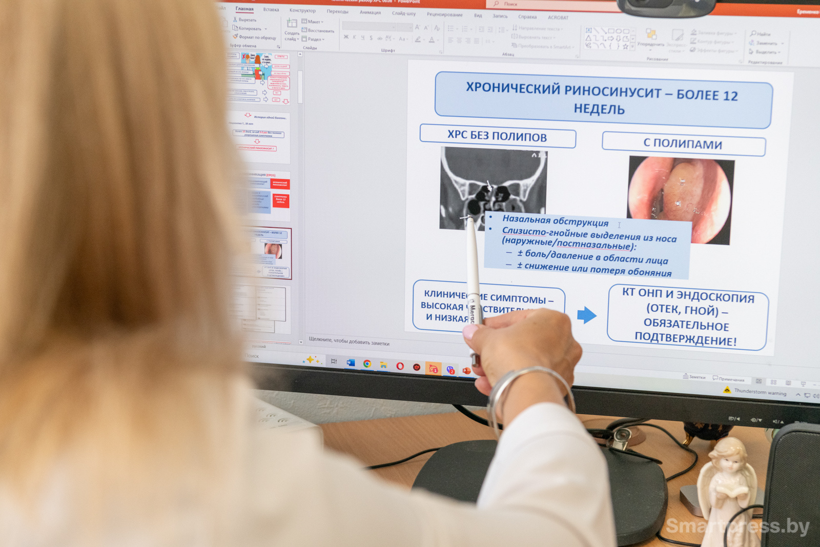 Хронический риносинусит