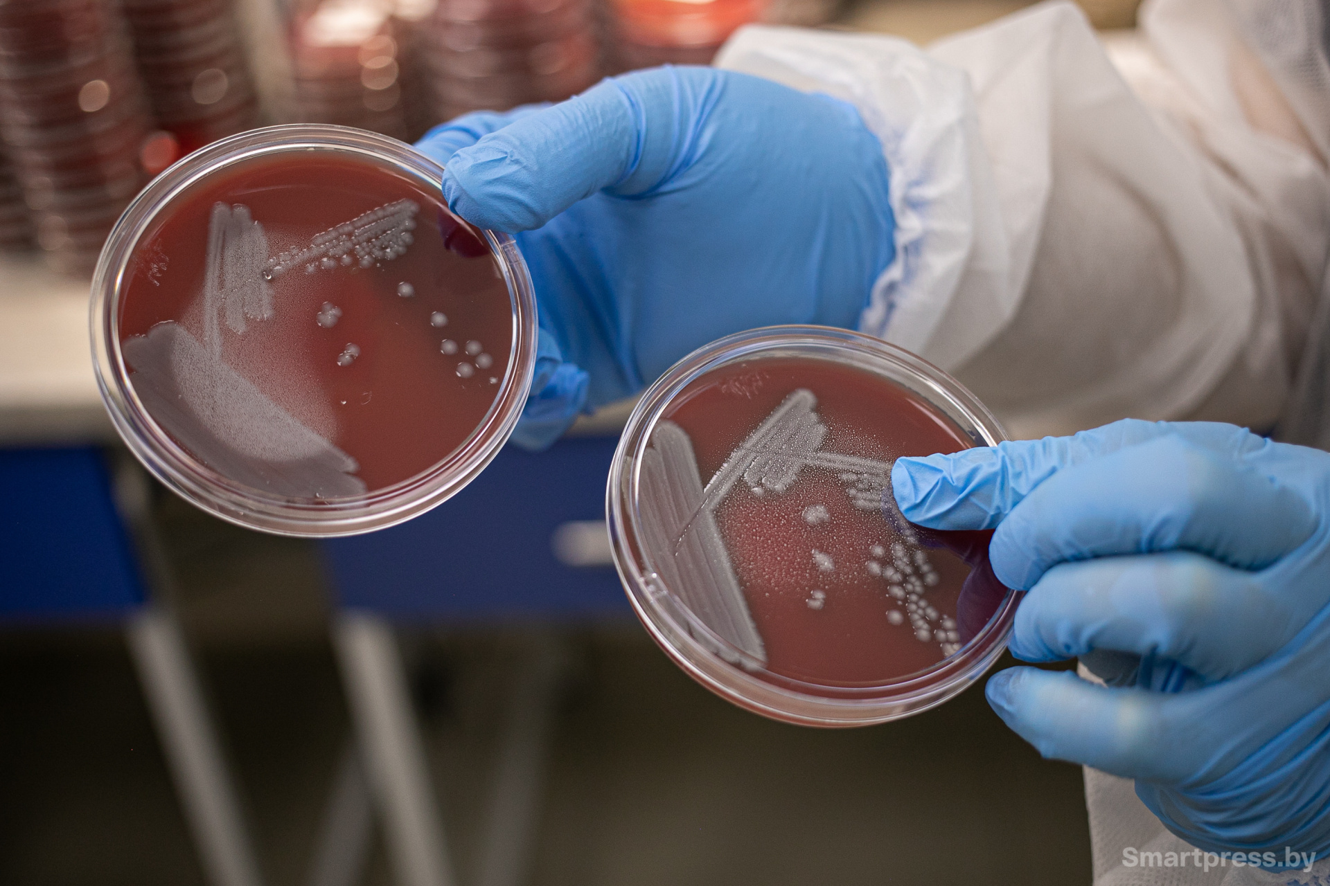 Микроорганизмы в чашке Петри