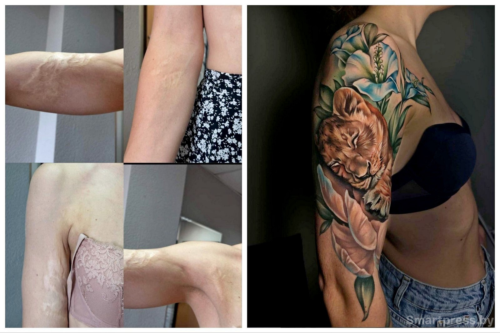 8-Татуировки на месте шрамов.jpg