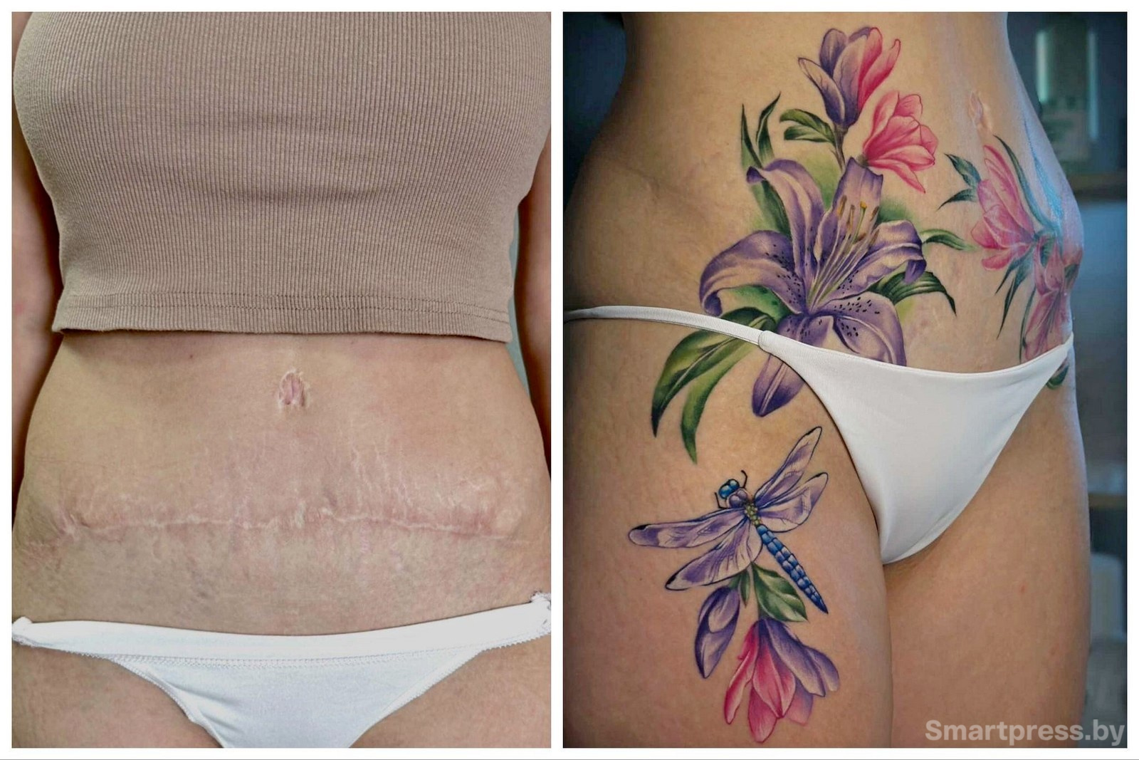7-Татуировки на месте шрамов.jpg