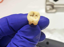 В спешке и без гробов. Массовое захоронение жертв Юстиниановой чумы нашли в Иордании