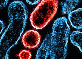 В Индии подтвердили вспышку смертельно опасного вируса Нипах – лекарства от него нет