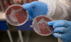 “Эта бактерия пахнет как земляника”. Репортаж из лаборатории, где “вычисляют” возбудителей болезней