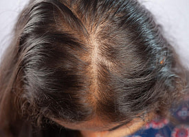 Почему одинаковую причёску нельзя носить каждый день? Трихолог объяснила