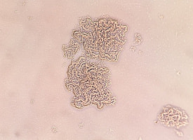 Туберкулёз научился прятаться в иммунных клетках – он ломает их изнутри