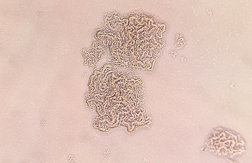 Туберкулёз научился прятаться в иммунных клетках – он ломает их изнутри