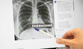 “Состояние – будто грузовик переехал”: 5 признаков, которые могут указывать на пневмонию