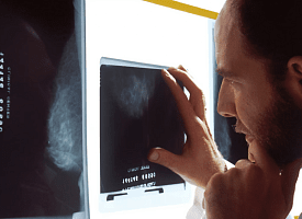 Более трети случаев рака можно предотвратить – учёные назвали 3 главных фактора риска