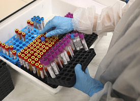 Почему для большинства анализов кровь берут из вены, а не из пальца? Спросили в лаборатории