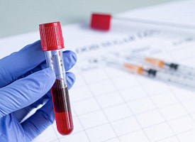 Рак научились “ловить” по крови ещё до симптомов – учёные из США предложили новый тест