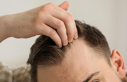 Не пересадка и не крем: учёные придумали новое средство от выпадения волос