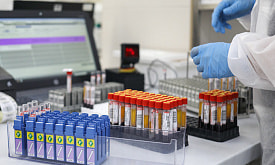 “Если результат анализа “зашкаливает”, его перепроверяют”. Посмотрели, как работает современная медицинская лаборатория