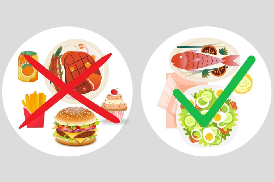 Атеросклероз 5.jpg