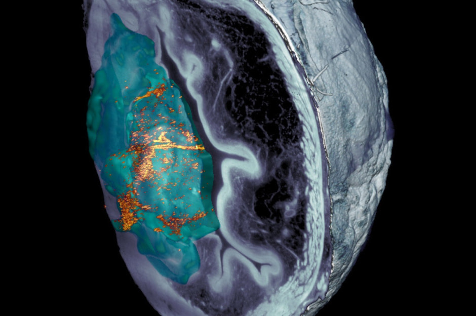 Мочевой пузырь.jpg