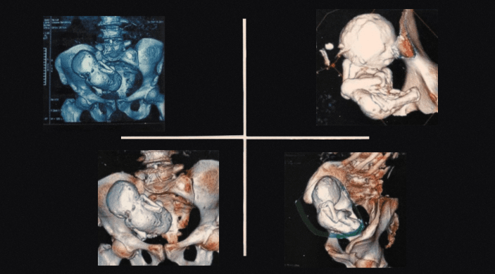 окаменелый ребенок.png