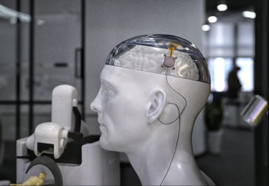 Интерфейс «мозг-компьютер», разработанный китайской компанией NeuroXess. Фото Chengdu Economic Daily