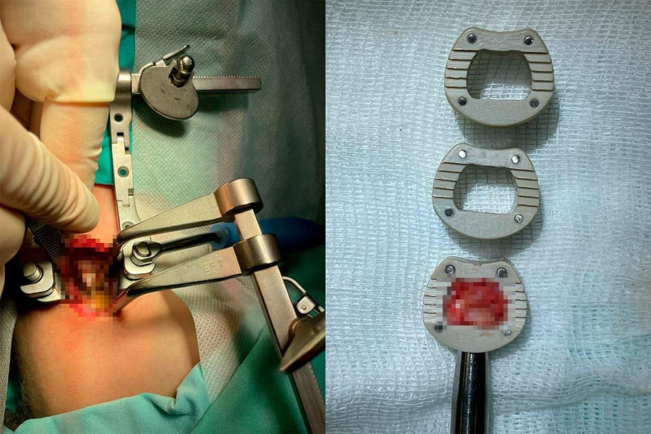 шея3.jpg шея3.jpg