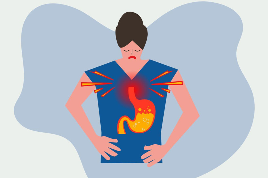 izhoga5.jpg izhoga5.jpg