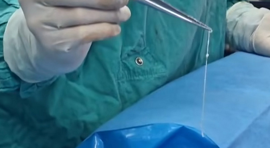 червь в мозге 2.png